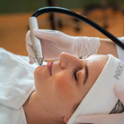 Mikrodermabrasion bei Akne und unreiner Haut – Heilpraxis Aichach