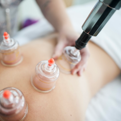 Schröpftherapie als naturheilkundliche Ausleitungstherapie – Heilpraxis Aichach